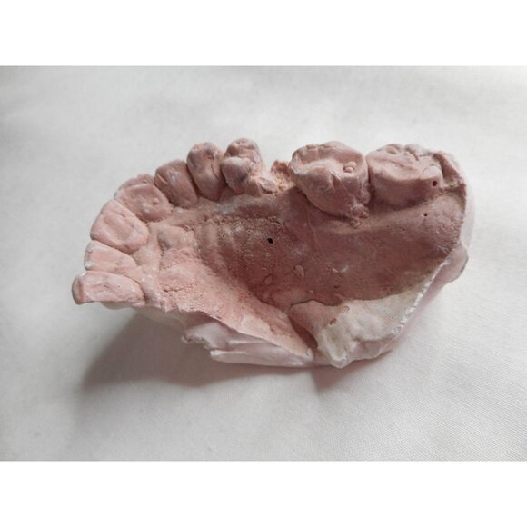 Vintage Cast Dental Teeth Mold  Tooth Castings #11 - Picture 3 of 5